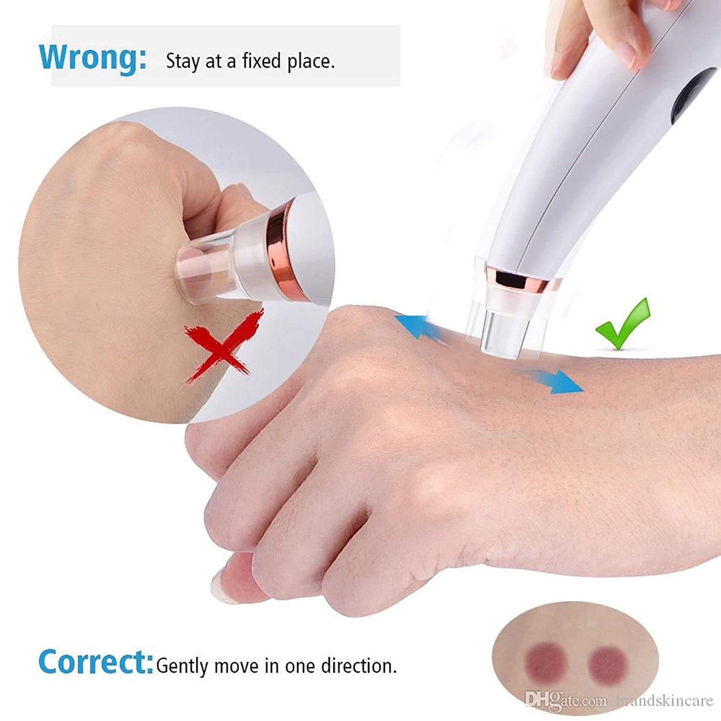 ClearGlow Blackhead Remover
