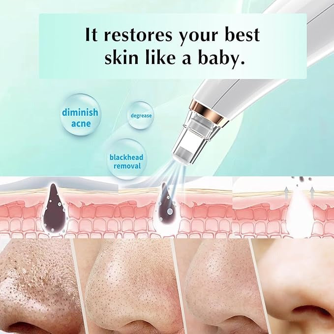 ClearGlow Blackhead Remover