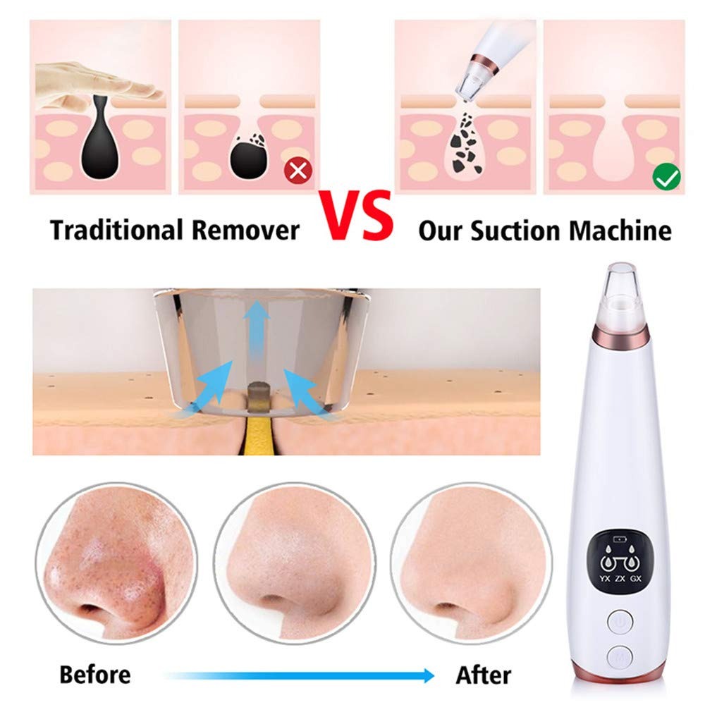 ClearGlow Blackhead Remover